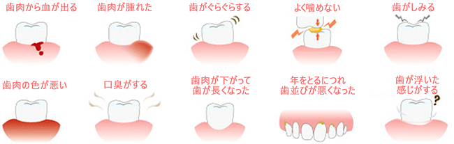 歯周病は初期症状のない、重症化しやすい病気です。このような症状がありましたら、歯周病の可能性がありますので、まずは検査をおすすめします